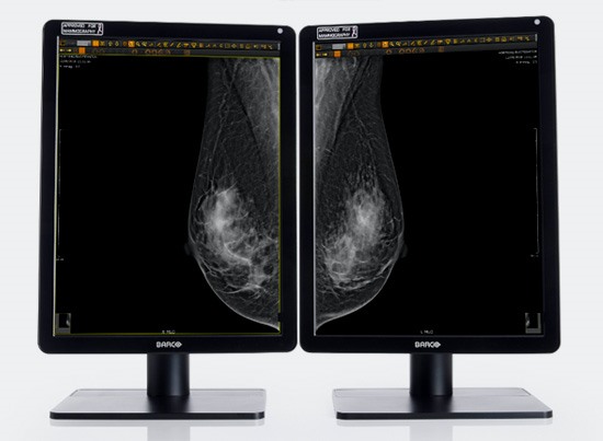 dijital-mamografi-gorsellestirme-raporlama